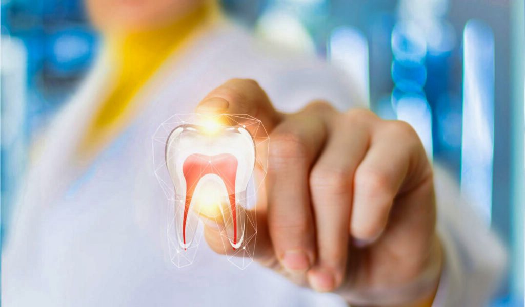 Process of finding root canal specialist